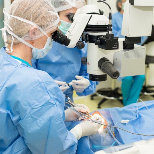 operație cataractă