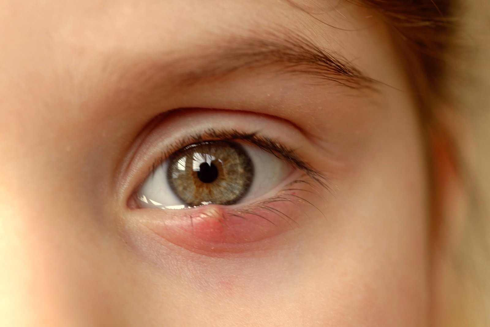 inflamație a ochilor și vedere încețoșată