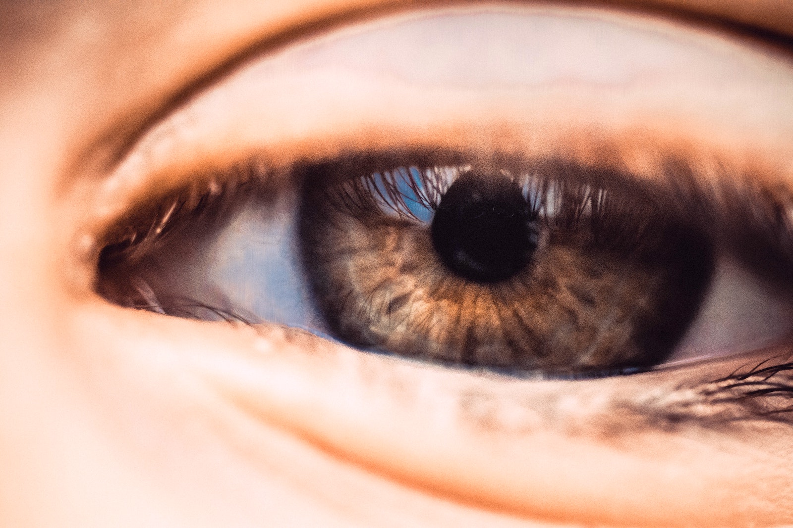 melanină și vedere cu glaucom, se dezvoltă miopie sau hipermetropie