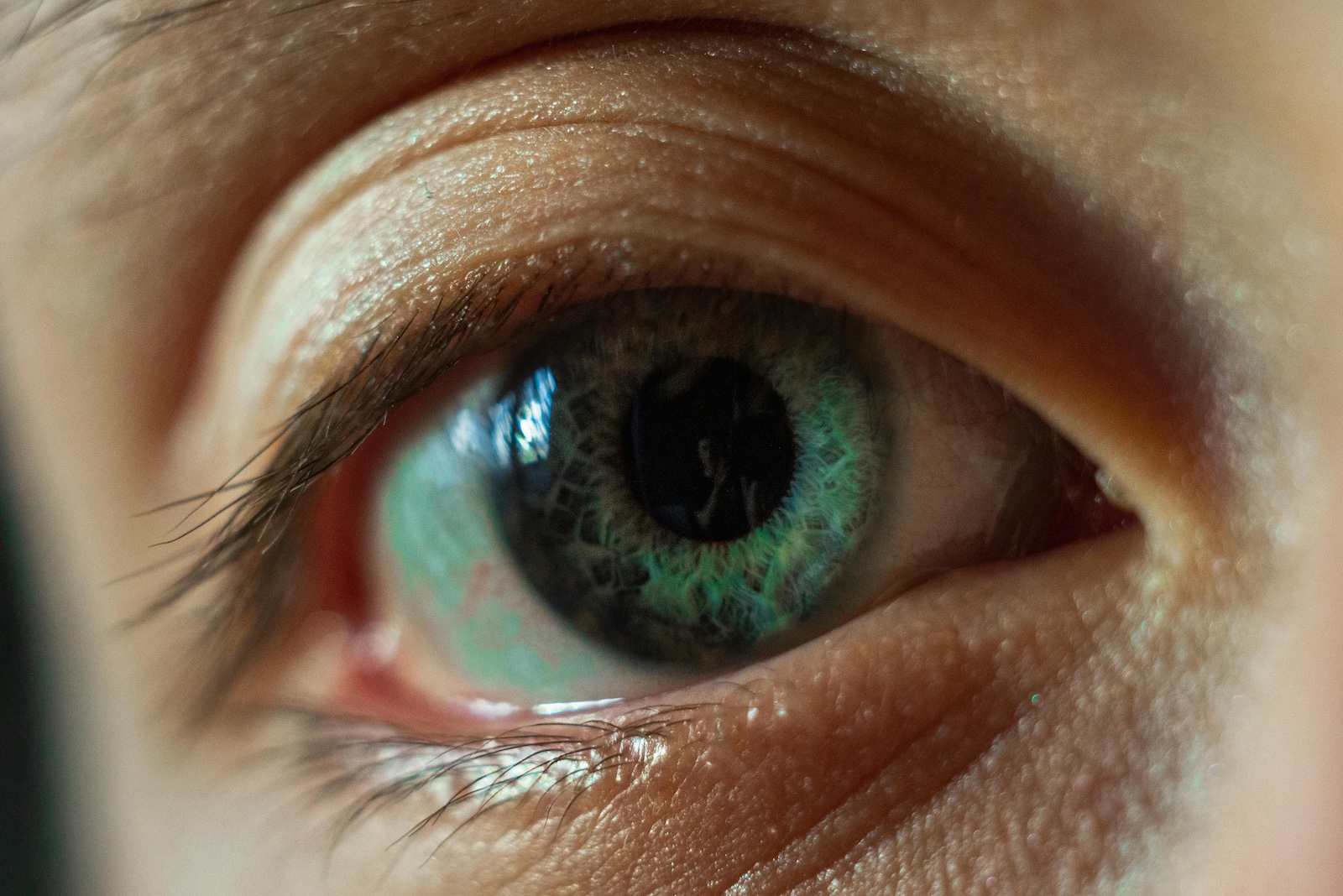 presiunea intraoculara